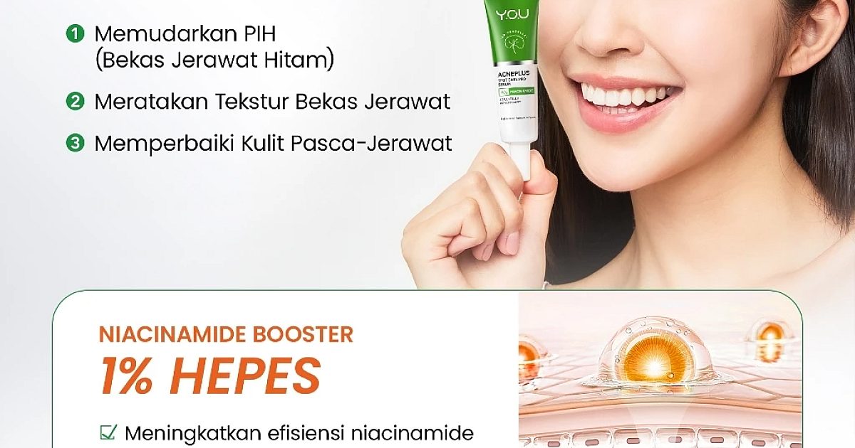 Review YOU AcnePlus Spot Care Pro Serum: Bantu Redakan Jerawat & Hilangkan Bekas